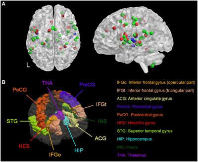 A Computational Assessment of Target Engagement in the Treatment of Auditory Hallucinations with Transcranial Direct Current Stimulation